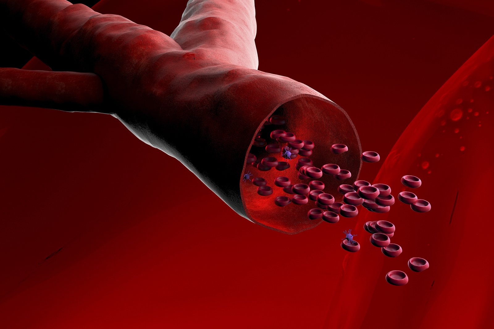 En este momento estás viendo Descubren el mecanismo responsable de los vasos sanguíneos anómalos en la cirrosis
