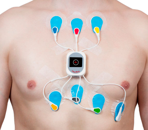 Lee más sobre el artículo Para qué sirve un Monitor Holter